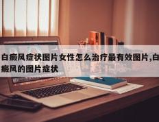 白癜风症状图片女性怎么治疗最有效图片,白癜风的图片症状