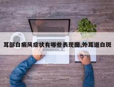 耳部白癜风症状有哪些表现图,外耳道白斑