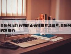 白癜风治疗药物的正确使用方法图片,白癜风的常用药