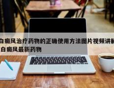 白癜风治疗药物的正确使用方法图片视频讲解,白癜风最新药物