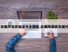 白癜风症状描述大全图解,白癜风症状及图片