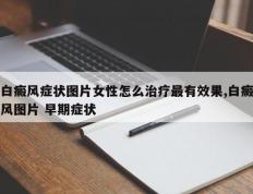 白癜风症状图片女性怎么治疗最有效果,白癜风图片 早期症状