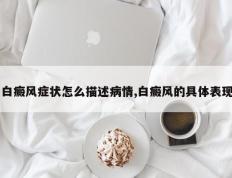 白癜风症状怎么描述病情,白癜风的具体表现