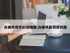 白癜风症状的初期图,白癜风最初症状图