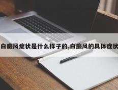 白癜风症状是什么样子的,白癜风的具体症状