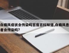 白癜风症状会传染吗百度百科知道,白癜风患者会传染吗?