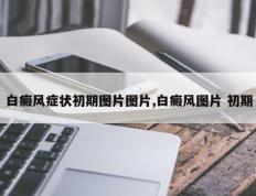 白癜风症状初期图片图片,白癜风图片 初期