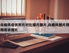 白癜风症状照片对比图片图片,白癜风图片初期症状图片