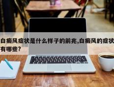 白癜风症状是什么样子的前兆,白癜风的症状有哪些?