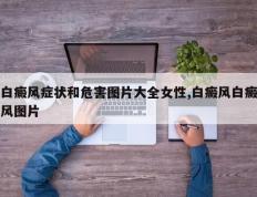 白癜风症状和危害图片大全女性,白癜风白癜风图片