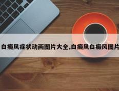 白癜风症状动画图片大全,白癜风白癜风图片