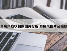 白癜风症状初期图片分析,白癜风图片及症状