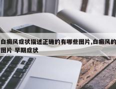白癜风症状描述正确的有哪些图片,白癜风的图片 早期症状