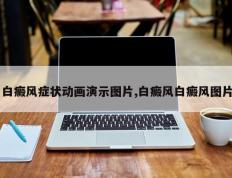 白癜风症状动画演示图片,白癜风白癜风图片