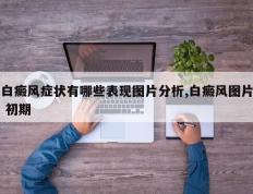 白癜风症状有哪些表现图片分析,白癜风图片 初期