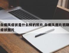 白癜风症状是什么样的照片,白癜风图片初期症状图片