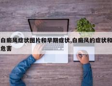 白癜风症状图片和早期症状,白癜风的症状和危害