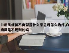 白癜风症状不典型是什么意思呀怎么治疗,白癜风是不规则的吗