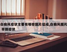 白癜风症状主要有哪些图片组成,白癜风图片 早期症状
