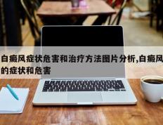 白癜风症状危害和治疗方法图片分析,白癜风的症状和危害