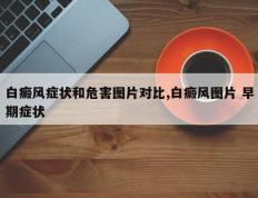 白癜风症状和危害图片对比,白癜风图片 早期症状