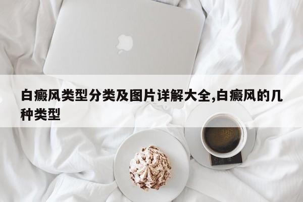 白癜风类型分类及图片详解大全,白癜风的几种类型