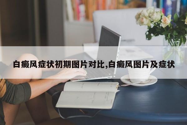 白癜风症状初期图片对比,白癜风图片及症状