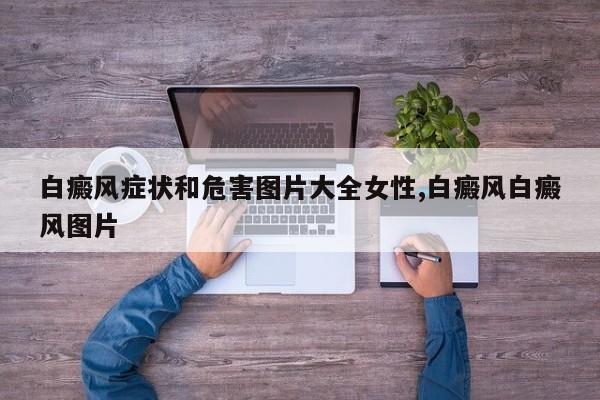 白癜风症状和危害图片大全女性,白癜风白癜风图片