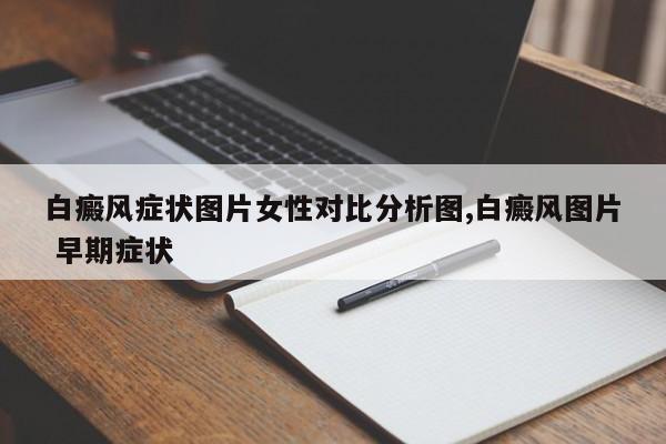 白癜风症状图片女性对比分析图,白癜风图片 早期症状
