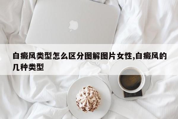 白癜风类型怎么区分图解图片女性,白癜风的几种类型