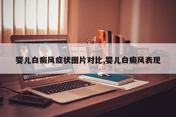 婴儿白癜风症状图片对比,婴儿白癜风表现