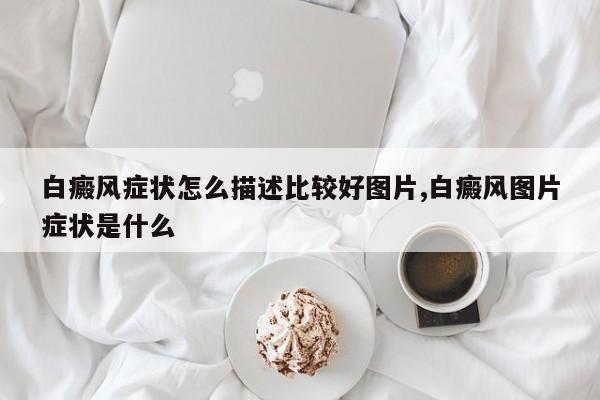 白癜风症状怎么描述比较好图片,白癜风图片症状是什么