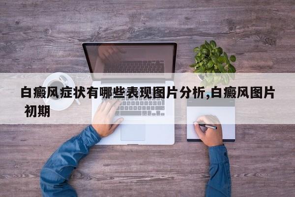白癜风症状有哪些表现图片分析,白癜风图片 初期