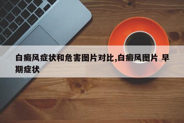 白癜风症状和危害图片对比,白癜风图片 早期症状