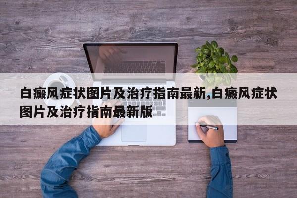 白癜风症状图片及治疗指南最新,白癜风症状图片及治疗指南最新版