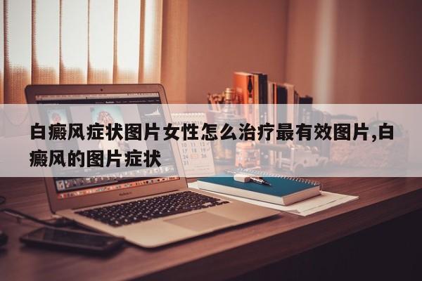 白癜风症状图片女性怎么治疗最有效图片,白癜风的图片症状