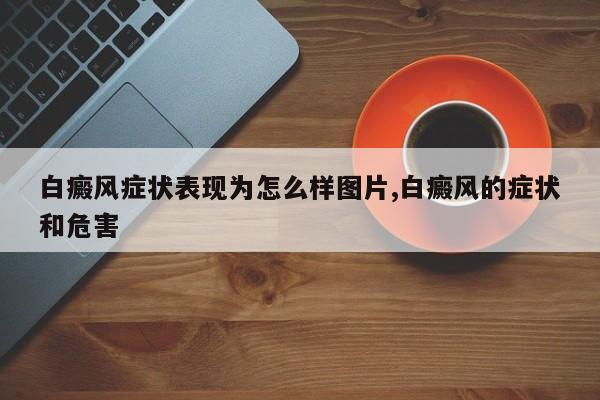 白癜风症状表现为怎么样图片,白癜风的症状和危害