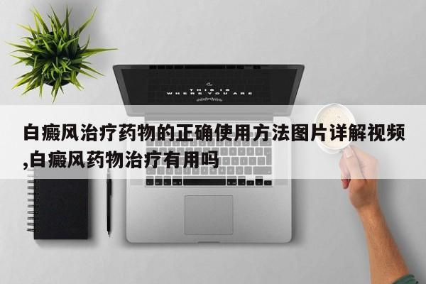 白癜风治疗药物的正确使用方法图片详解视频,白癜风药物治疗有用吗