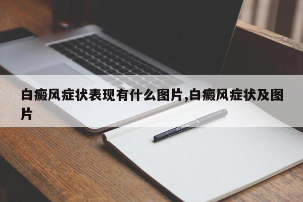 白癜风症状表现有什么图片,白癜风症状及图片