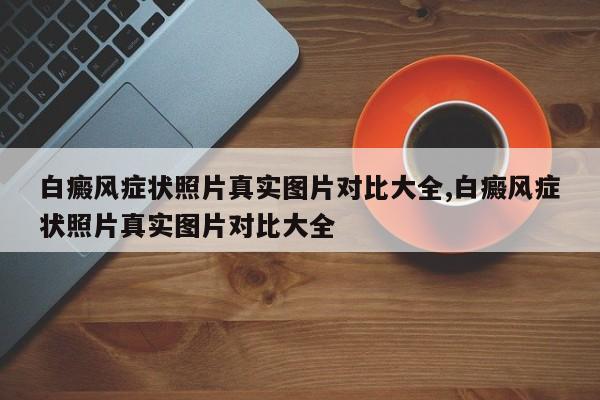 白癜风症状照片真实图片对比大全,白癜风症状照片真实图片对比大全