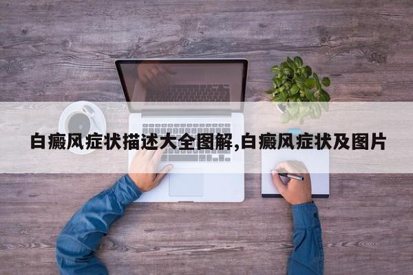 白癜风症状描述大全图解,白癜风症状及图片