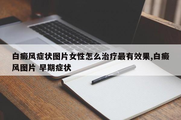 白癜风症状图片女性怎么治疗最有效果,白癜风图片 早期症状