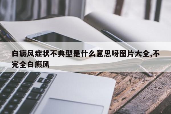 白癜风症状不典型是什么意思呀图片大全,不完全白癜风