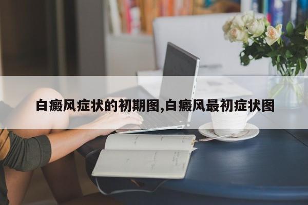 白癜风症状的初期图,白癜风最初症状图