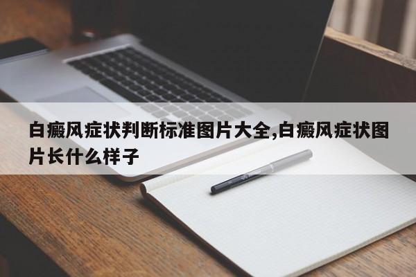 白癜风症状判断标准图片大全,白癜风症状图片长什么样子
