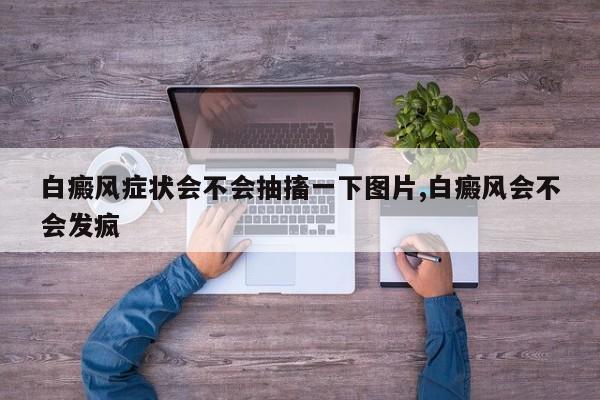 白癜风症状会不会抽搐一下图片,白癜风会不会发疯