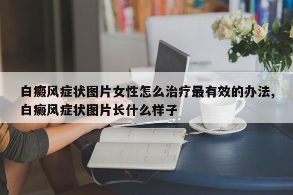 白癜风症状图片女性怎么治疗最有效的办法,白癜风症状图片长什么样子